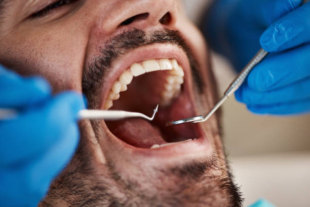 Best Emergency Treatment for Oral Infections in Mundys Corner, PA